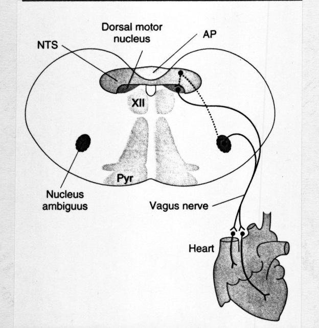 Gátló kapcsolat a rosztralis ventrolaterális medulla felé (RVLM) BAROREFLEX PÁLYÁK A NYÚLTVELŐBEN PARASZIMPATIKUS