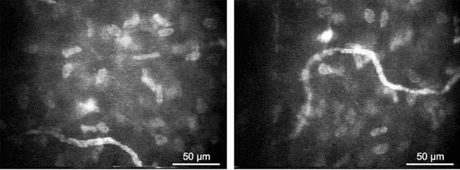 A szubepitheliális plexus a Bowmanmembrán és a stroma között található, sokszor kapcsolatban van a Bowman-membránt áttörő kis idegrostok révén a szubbazális plexusszal.