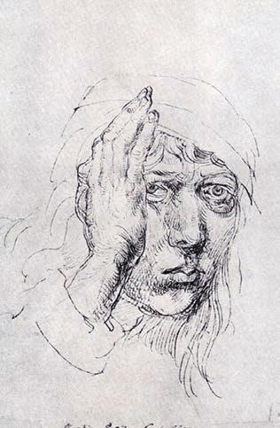 ábra), van szó, hanem az önarckép-készítés időnként megjelenő melléktermékéről (5). Dürer 13 ismert önarcképe közül 4 képen egyértelmű jobb oldali exotropia figyelhető meg.
