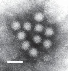 Family Caliciviridae Lagovirus, Vesivirus, Sapovirus, Norovirus Only sapovirus and norovirus can infect humans Genome: Single-stranded, positive-sense RNA genome of ~7.7 kb.