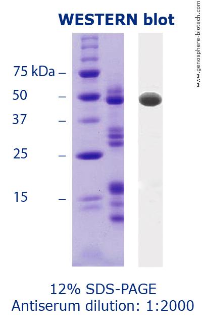 Western blot Western