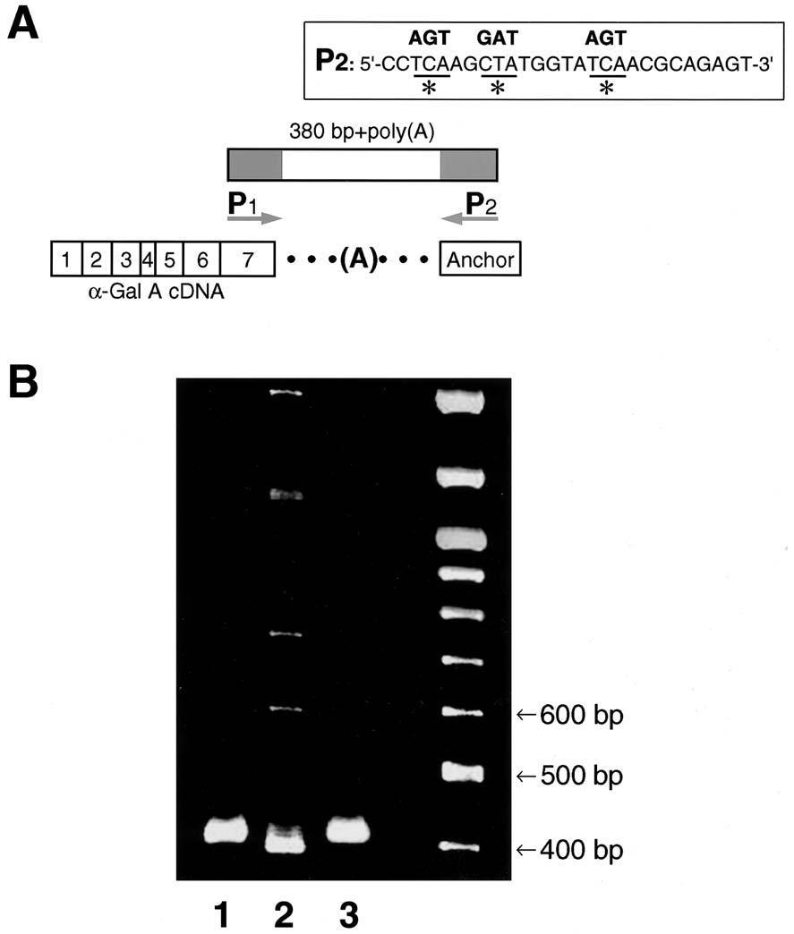 Yasuda et al.: Unique 3 -End Lesions Cause Fabry Disease 165 Figure 1 3 RACE PCR analysis, using normal and mutant lymphoblasts. A, Design of 3 RACE PCR.