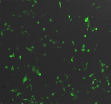 24. ábra. Az egfp aktivitás mérése. Az UV mikroszkóp alatt a fertőzött sejtek zöld fluorescenciát mutattak. Számolható, így kvantitatív módon értékelhetőek az eredmények. 5.2. A kísérleteinkben