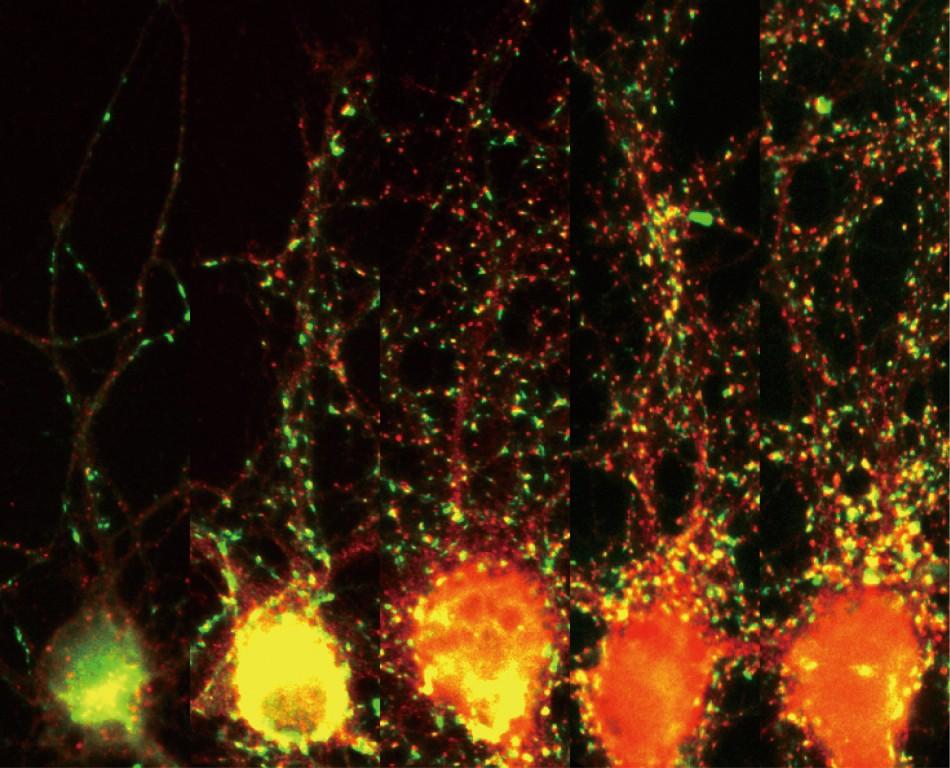 Szinapszisok kialakulása az ontogenezis során in vitro. Az ábrán patkány hippokampális neuron kúltúra látható 6, 9, 12, 16 és 20 napos korban (balról jobbra).