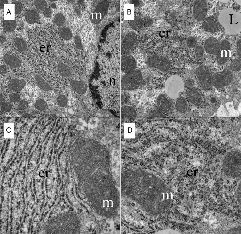 (m) sejtmag (n) B, D irreguláris elrenedződésű RER, mitokondriumok változatos