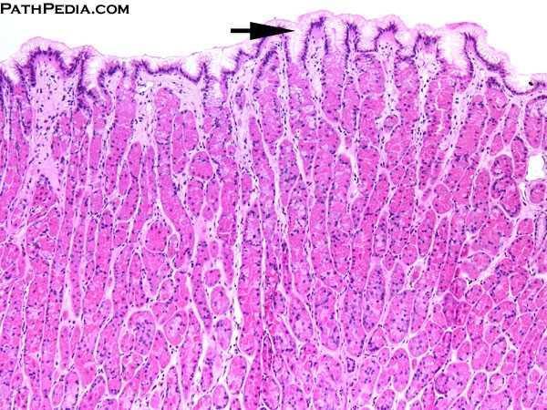 Gyomor részei cardia fundus