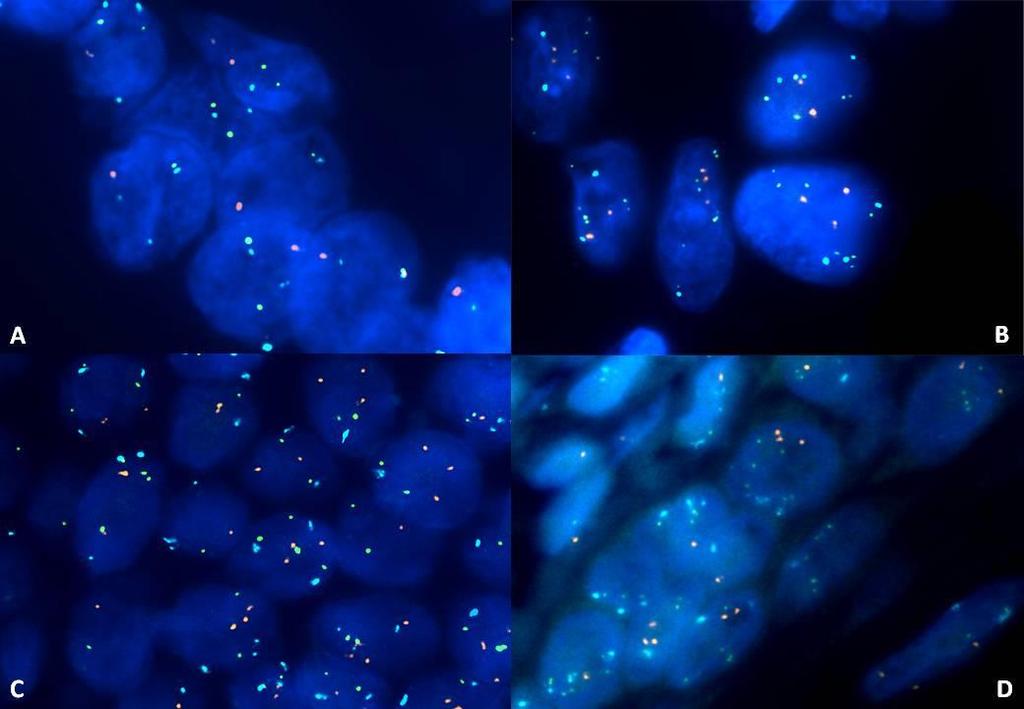 15. ábra. FISH képek negatív és pozitív kontrollokon. A: FISH negatív kontroll sejteken; a sejtekben azonos számú zöld és kék jel látható.