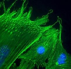 Citoszkeleton: eukarióta sejtek dinamikus fehérjevázrendszere