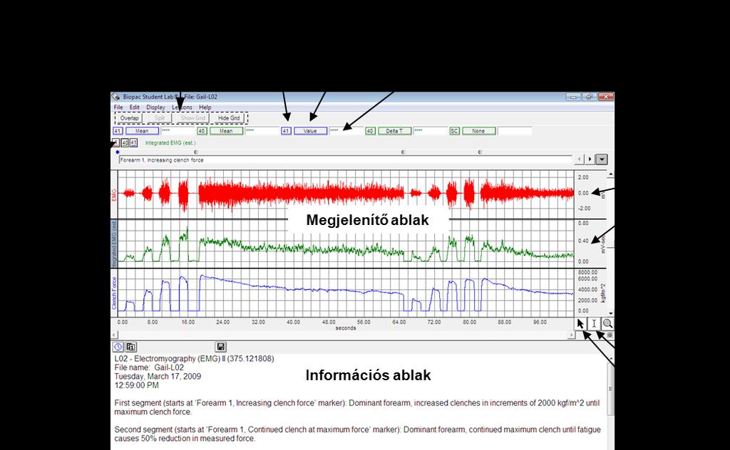 A mérés során általánosan a következő indító- és leállító gombok állnak rendelkezésre: Kalibráció Mérés Calibrate Az erősítés beállítása Record A felvétel indítása Redo calibration A kalibrálás