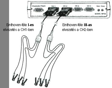 Az MP30/35/36 erősítőegység kikapcsolt állapotában csatlakoztassuk az EKG elektródák (SSL2) elvezetését az erősítő egyes és kettes csatornájához úgy, hogy Az I-es elvezetés a CH1-hez, a III-as