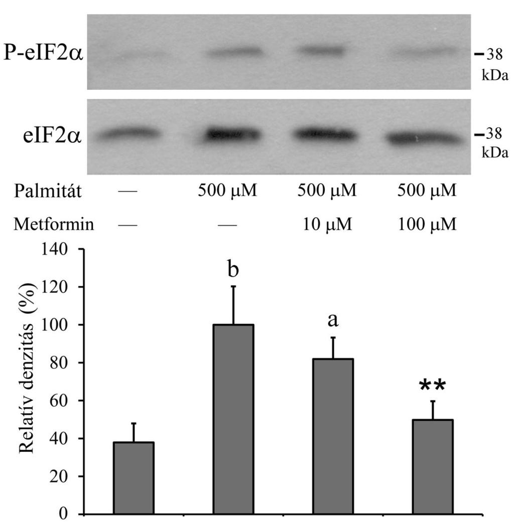8. ábra: eif2α-foszforiláció RINm5F patkány inzulinóma sejteket kezeltünk palmitáttal (500 M) önmagában, valamint metforminnal együtt (10 M, 100 M) 70-80%-os konfluenciánál.