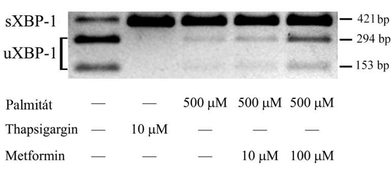10. ábra: IRE1-függő XBP-1 mrns-hasítás RINm5F patkány inzulinóma sejteket kezeltünk thapsigarginnal pozitív kontrollként, valamint palmitáttal (500 M) önmagában, vagy metforminnal (10 M, 100 M)