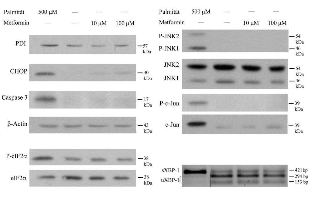 12. ábra: Metformin kezelés önmagában RINm5F patkány inzulinóma sejteket kezeltünk palmitáttal (500 M) pozitív kontrollként és metforminnal önmagában (10 M és 100 M) 70-80%-os konfluencia mellett.