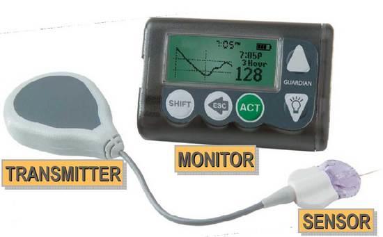 6. ábra. A Guardian-RT típusú RT-CGM rendszer (Medtronic). Az egyszer használatos szenzor élettartama 6-7 nap, amit speciális belövő készülékkel helyeznek a subcutan szövetbe.