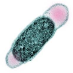 Can we Now Find Hidden Messages in Thermotoga petrophila?
