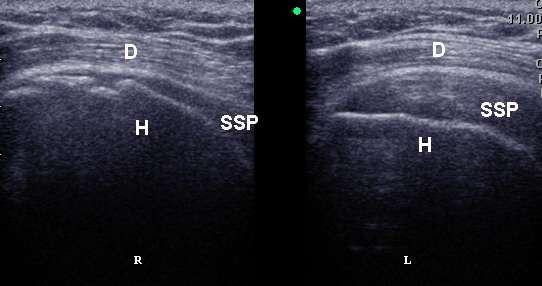 arthroscopia