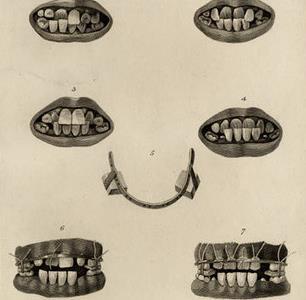 Az első, Aki csoportosította a malocclusio-kat (1803) Aki leírta a mandibula növekedését