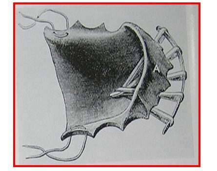 The upper part consisted of a simple network going over the head and having two hooks on each side, one hook being above and the other below the ear.