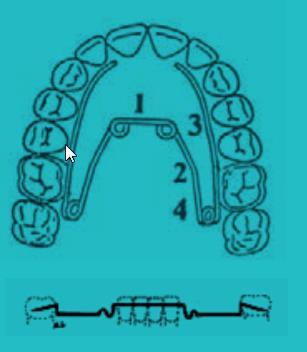 018 slot straightwire bracket with Rocky Mountain Orthodontics (1970) Esztétika a legfontosabb fogszabályozási cél, egyéni kezelési tervek