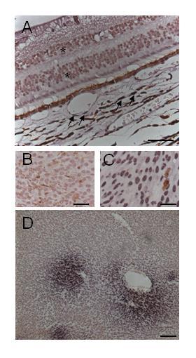 4.3. PAR expresszió uveális melanomában A szem tumormentes részein PAR magfestődést észleltünk a retina nukleáris rétegeiben (6. ábra) és az érhártya ereinek falában (6 A ábra).