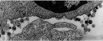 A humán immundeficiencia vírus