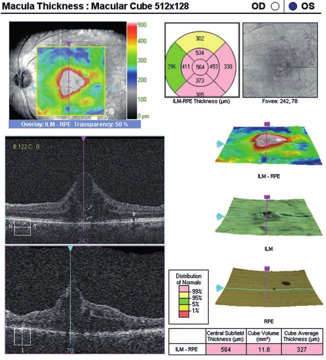 Management of diabetic macular edema 9.