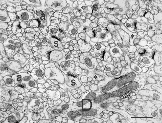 chains basement membrane Germinative zone in the developing forebrain (