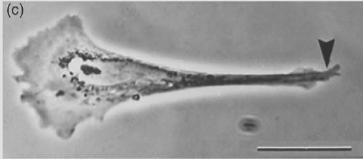 or Recruitment of further adhesion molecules; cell awachment Solid carrier Force generagon Ini7al contact: Cytoskeletal