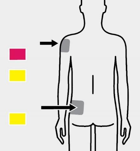 3 Injekció beadása A dózis befecskendezése Deltoid Rózsaszín csatlakozó vagy Sárga csatlakozó Glutealis Sárga csatlakozó A fecskendő