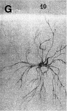 2011 1862, Wilhelm Kühne írta le a neuro-muszkuláris kapcsolatot és bevezette a végtalp (
