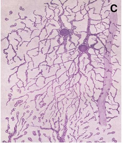 B, C : Astrocytes in the stratum lucidum of the human CA1 area of the