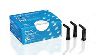 Fényrekötő kompozitok és bondrendszerek EverX Posterior (GC) A GC everx Posterior egy üvegszállal megerősített kompozit a dentin helyreállítására, más hagyományos kompozitokkal (pl.