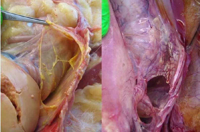 H5N1 / H5N2 / H5N9 Többségében nincs