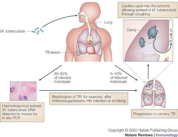 Pulmonáris Mycobacterium