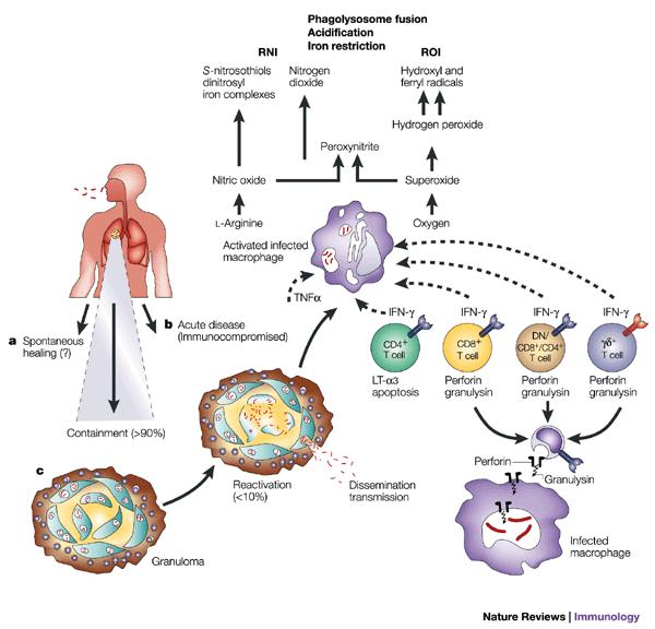 Mycobacterium tuberculosis fertőzés lehetséges kimenetelei Spontán