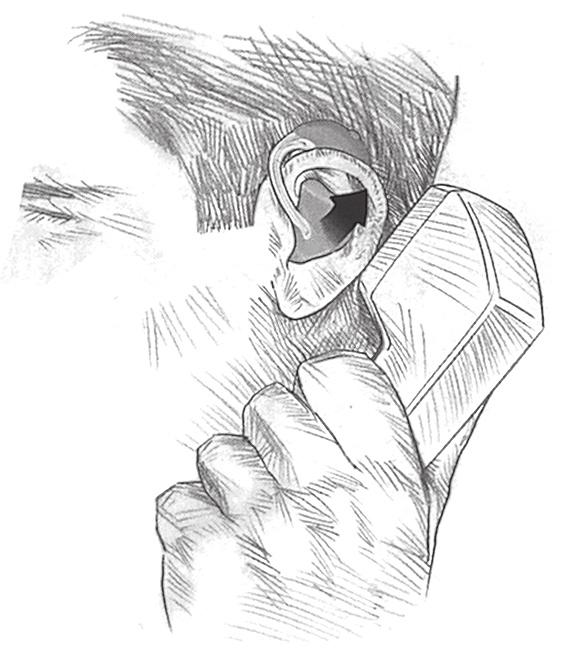 A TELEFON HASZNÁLATA Amennyiben fülmögötti készüléke rendelkezik érzékelô tekerccsel, akkor képes arra, hogy kizárólag a hallókészülékkel kompatibilis telefonból érkezô hangokat fogja.