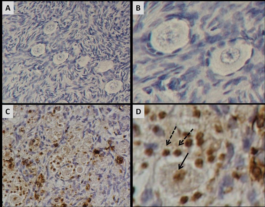 CYCLOPHOSPHOMIDE CONTROL Apoptotic death of oocytes and granulosa cells in human