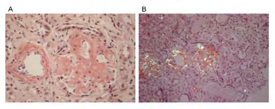 TÁRSBETEGSÉGEK Cardiovascularis