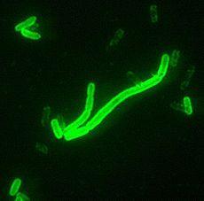 Elder Yersinia pestis seen at 200 magnification with a fluorescent