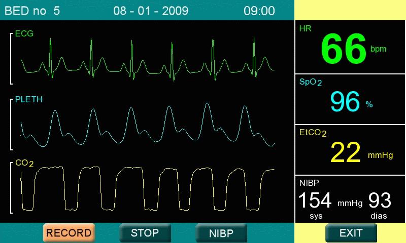 Előkészületek -monitor EKG SpO 2