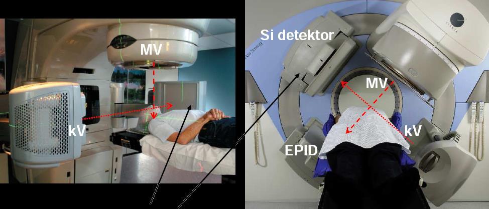 EPID + Cone