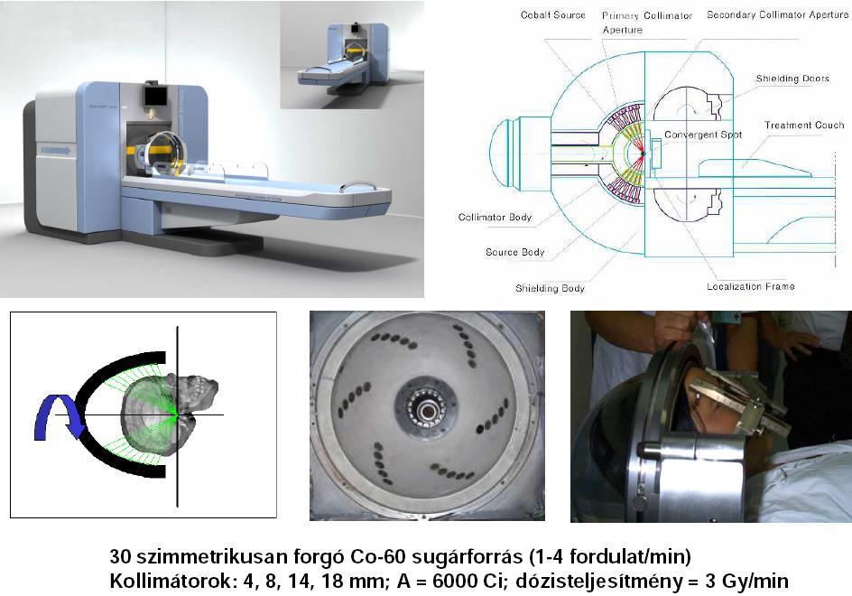 Forgó gamma-kés