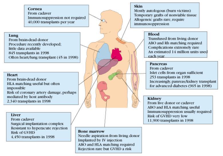 com) GVHD: Graft-versus-host disease is a rare medical complication following the receipt of transplanted tissue from a genetically