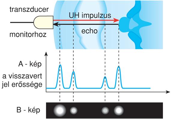 Ábrázolás: a képet leggyakrabban B (brightness)- módban ábrázolják, ahol a képen a kiszámolt távolságnak megfelelő helyen láthatóak a visszaverő felületek, és annál világosabb egy pont, minél nagyobb