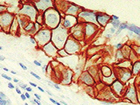 TGFa: transzformáló növekedési faktor-a, AR: amphiregulin EGF: epidermális növekedési faktor; HB-EGF: heparin-binding epidermális növekedési faktor; b-cel: béta-cellulin; EPI: epiregulin; NRG1: