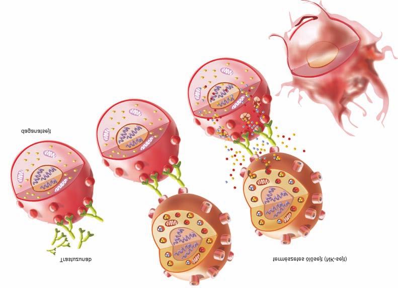 Dank Magdolna 3. ábra A trasztuzumab ADCC (antitest-dependens celluláris citotoxicitás) hatása.