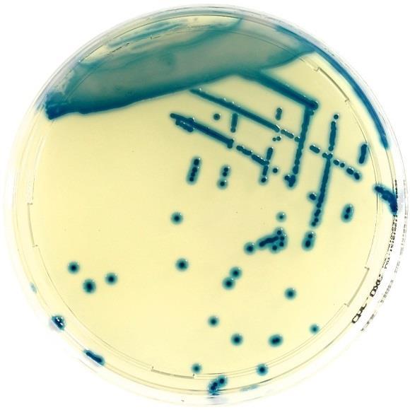 Spóraképző képességének köszönhetően a Bacillus cereus megtalálható a talajban, zöldségeken, állatok szőrén, vízben és üledékekben ezért gyakran hozható összefüggésbe élelmiszer eredetű