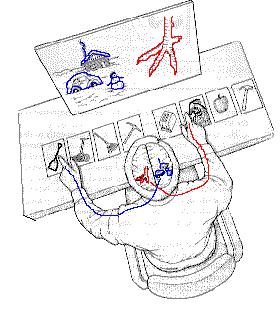 Split-brain /hasított agyú páciensek: Agykérgi lateralizáció vizsgálatára kitűnő alanyok. A bal oldalhoz kapcsolódik a nyelv, beszéd, probléma megoldás, a jobb oldalhoz a vizuálismotoros feladatok. 1.