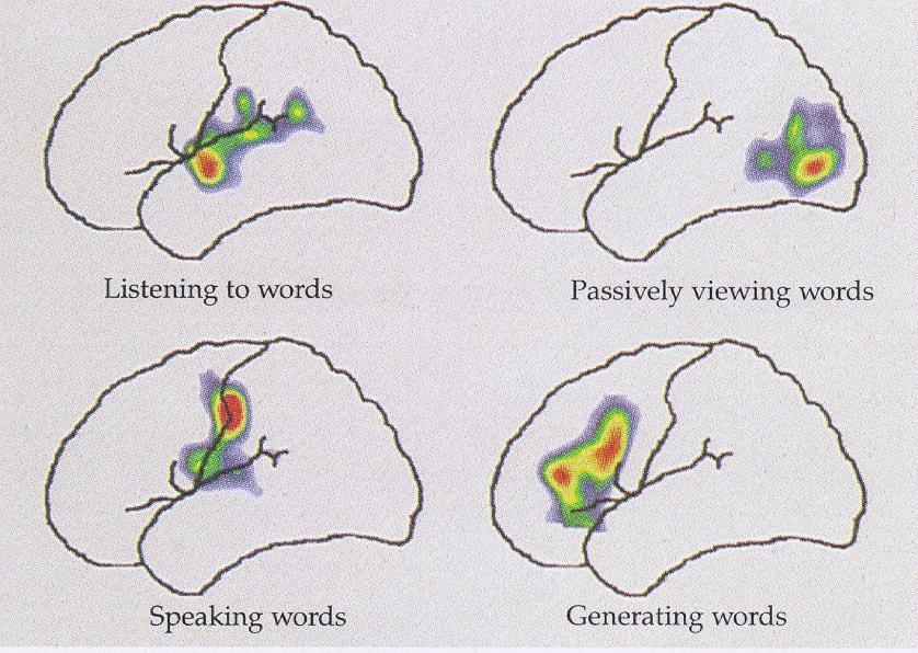 A nyelv alkomponenseinek neurális korrelátumai Ortografikus