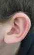 1. Külső fül Fülkagyló és külső hallójárat. 2. Középfül Dobhártya Dobüreg Hallócsontok. 3. Belsőfül Csontos és hártyás labirintus.